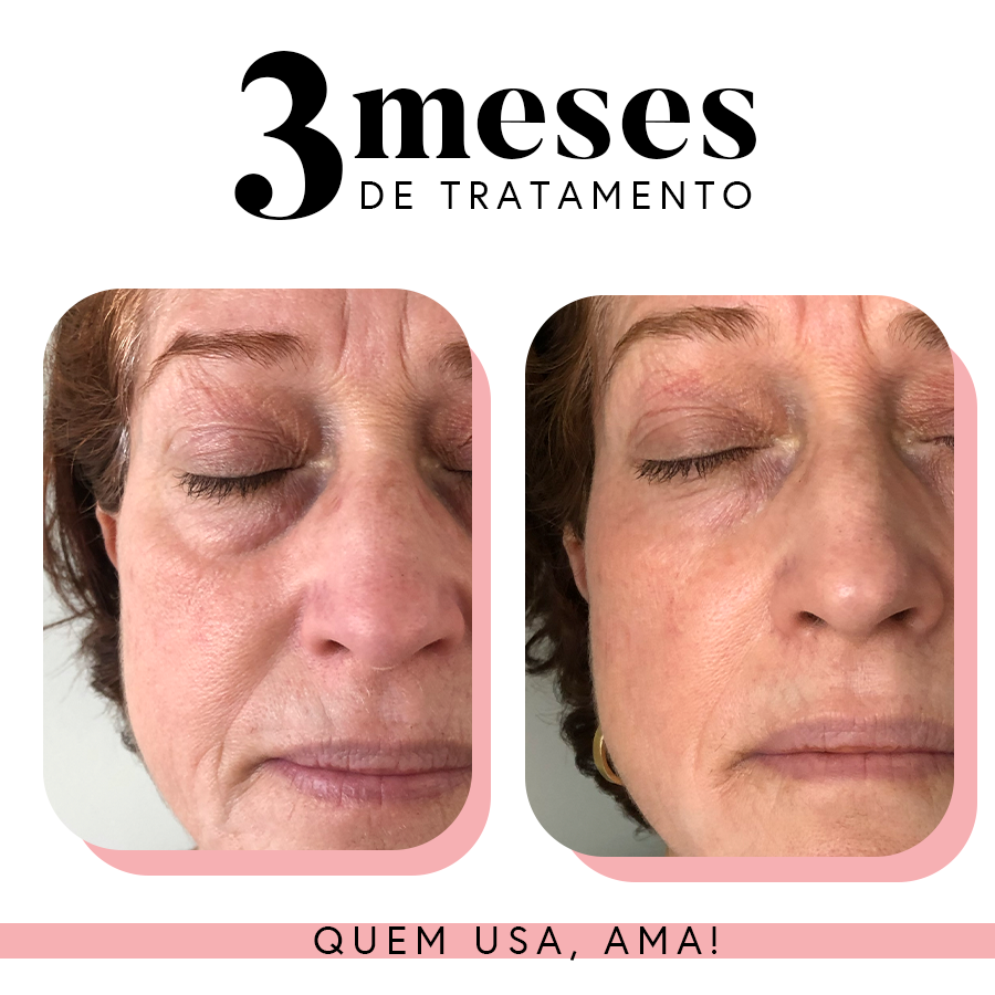 Kit Essencial Fabuloso Anti-Idade