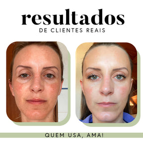 Fórmula Antioxi Nutri – Protetor Solar Oral (90 cápsulas – 3 meses)