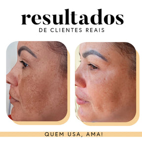 Fórmula Antioxi Nutri - Protetor Solar Oral - 30 cápsulas