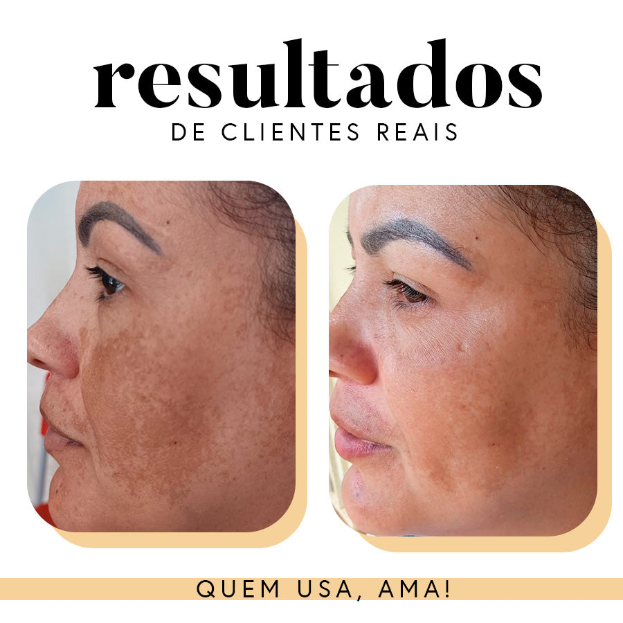 Fórmula Antioxi Nutri - Protetor Solar Oral - 30 cápsulas