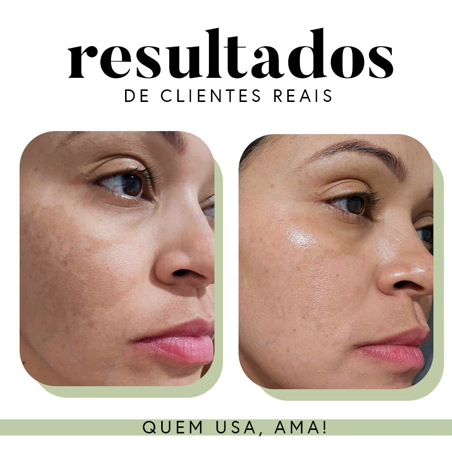 Fórmula Antioxi Nutri - Protetor Solar Oral - 30 cápsulas