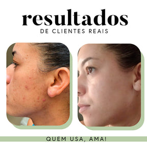 Fórmula Antioxi Nutri - Protetor Solar Oral - 30 cápsulas