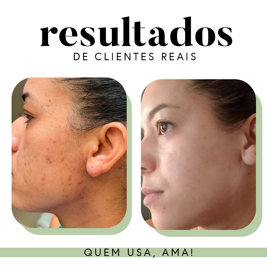 Fórmula Antioxi Nutri - Protetor Solar Oral - 30 cápsulas