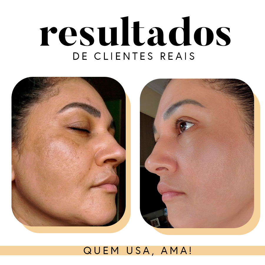 Fórmula Antioxi Nutri – Protetor Solar Oral (90 cápsulas – 3 meses)
